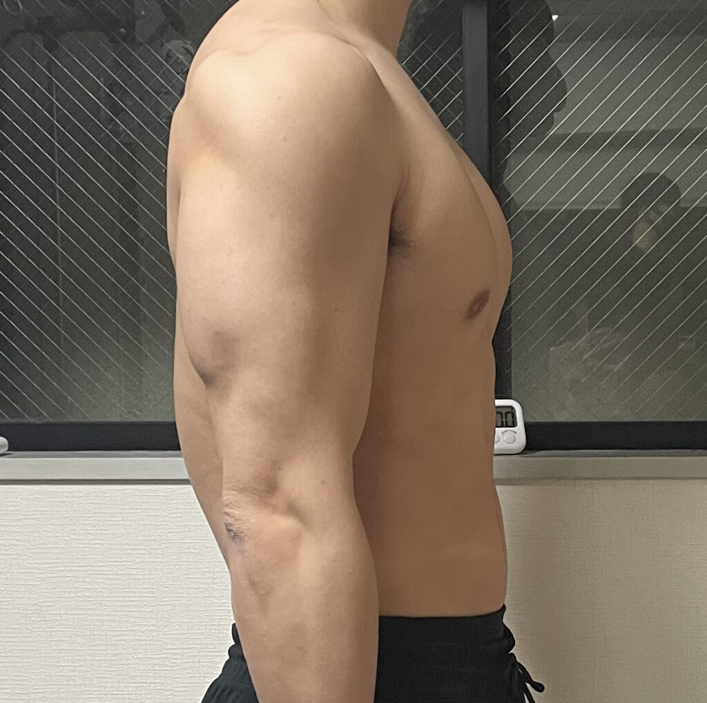 餅米ダイエット後画像